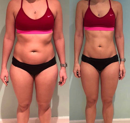 Weight Management Patches LunaGlow™ - LunaGlow