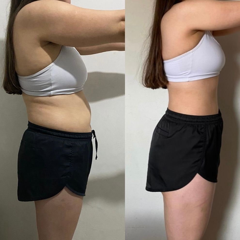 Weight Management Patches LunaGlow™ - LunaGlow